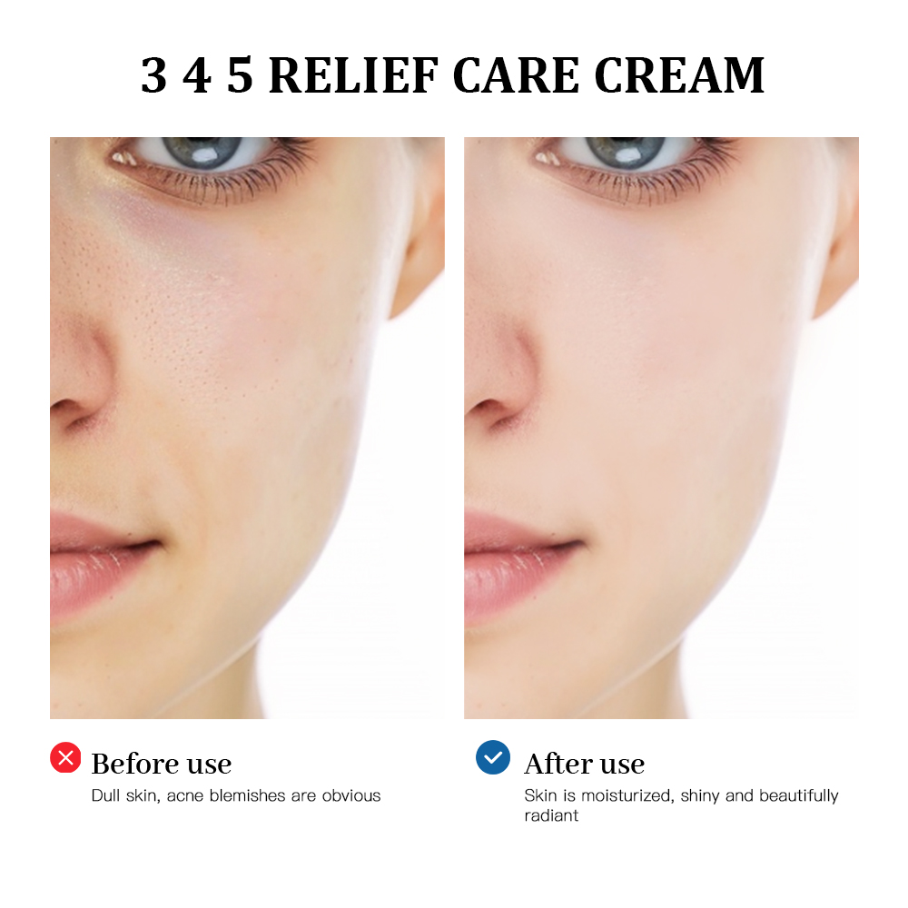345 Relief Cream solution to s - Photography Treatment avaliação e preço