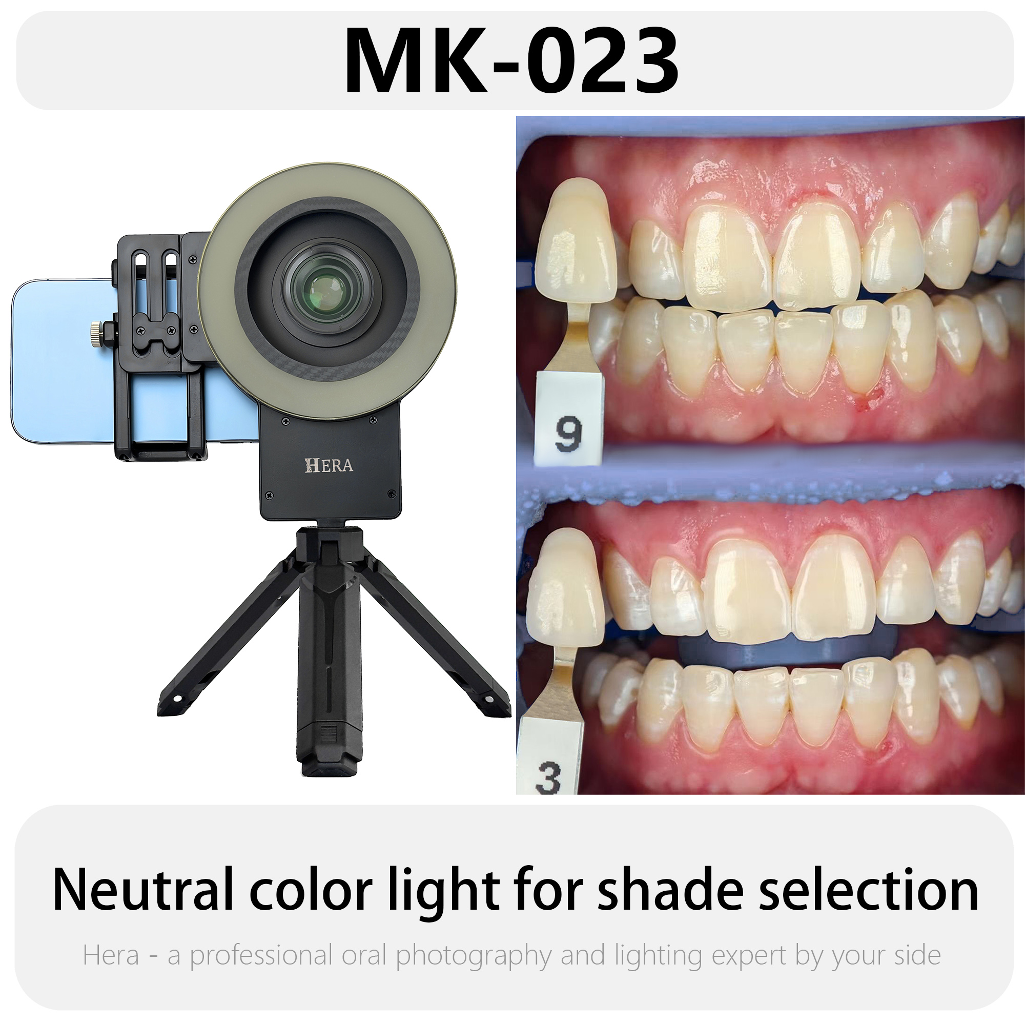 HERA MK-23 Intraoral Dental Ph - Photography Treatment avaliação e preço