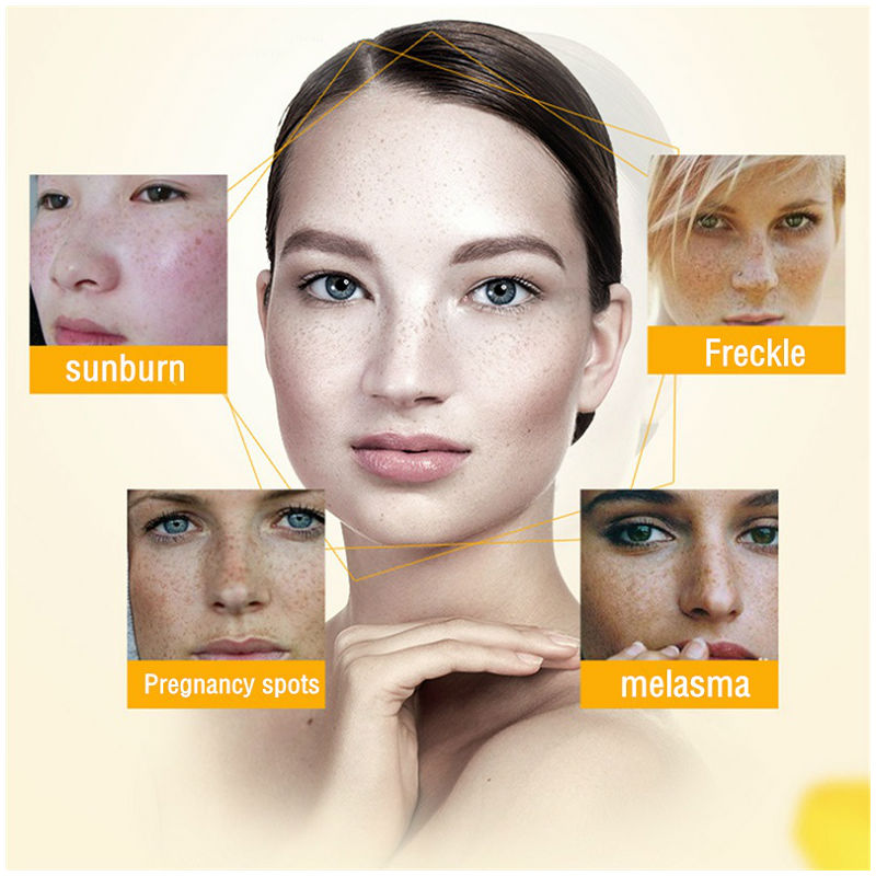 Dimollaure Whitening Freckle C - Photography Treatment avaliação e preço
