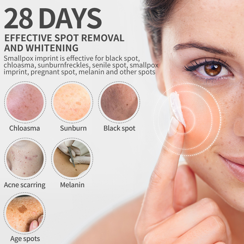 Dimollaure Whitening Freckle C - Photography Treatment avaliação e preço