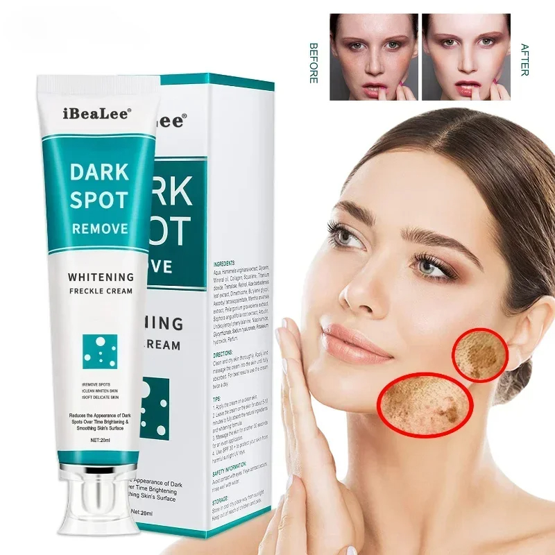 Whitening Freckle Cream Remove - Photography Treatment avaliação e preço