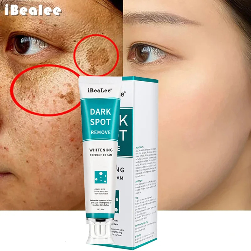 Whitening Freckle Cream Remove - Photography Treatment avaliação e preço