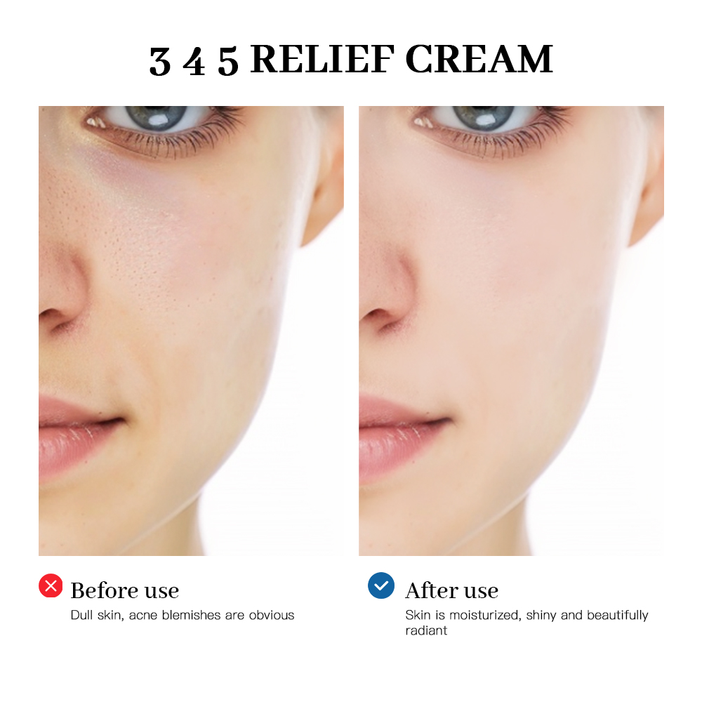 345 Relief Cream Address Blemi - Photography Treatment avaliação e preço